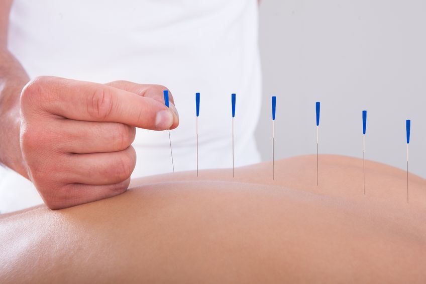 Acupuncture treatment